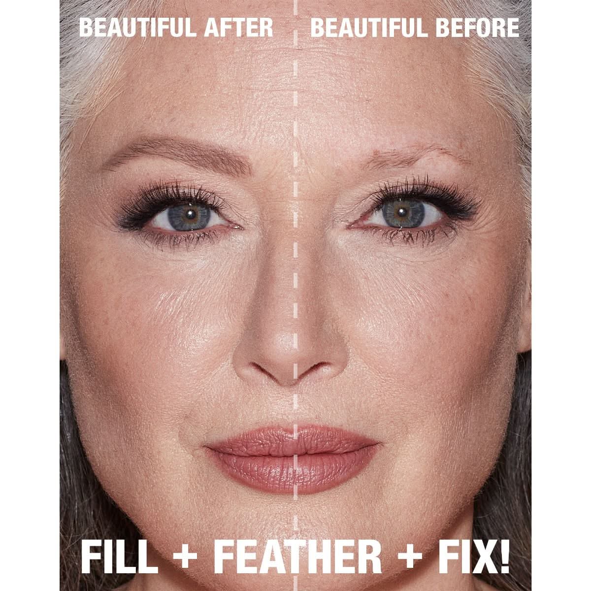 Brow Lift